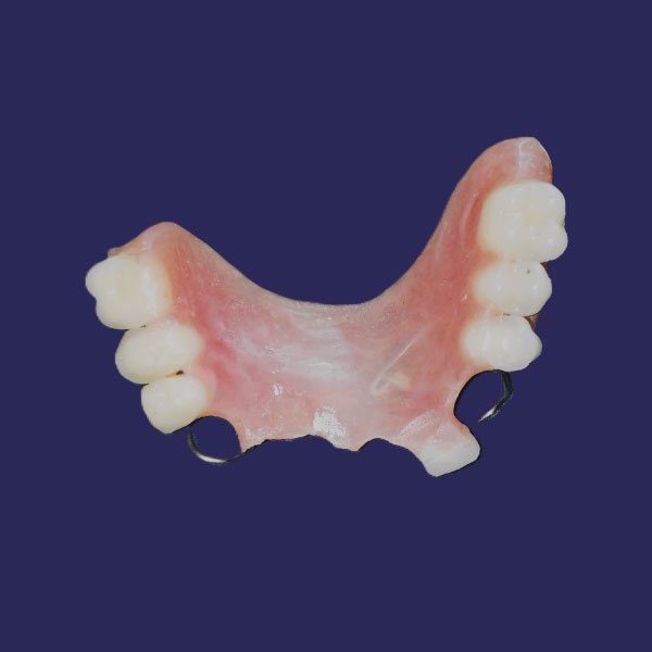 Acrylic Partial Dentures