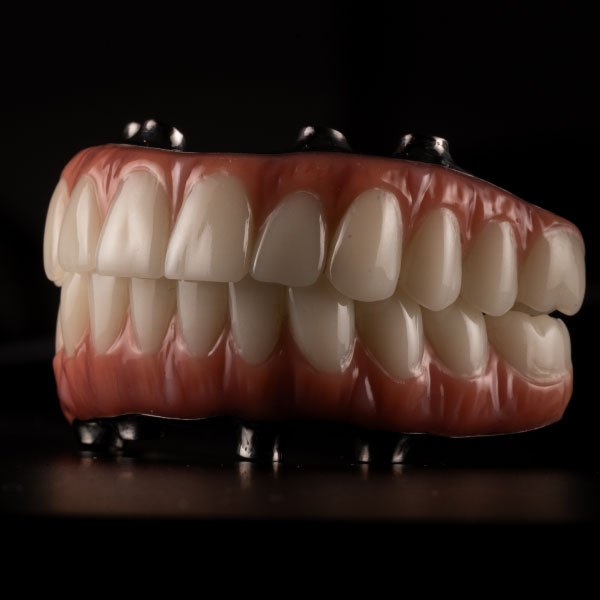 Implant-Supported Full Dentures