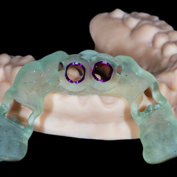 Surgical Guides