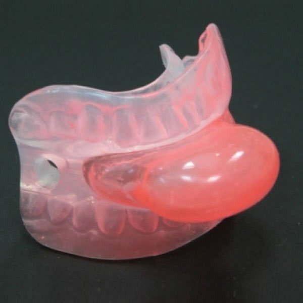 Tongue Retaining Devices (TRDs)